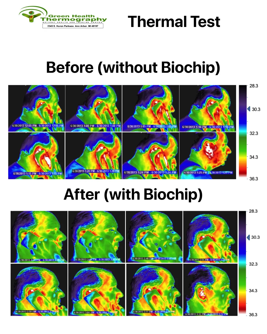 FLIR thermal imaging sequences — Before (without BioChip) showing intense red and white hot zones developing on the head, and After (with BioChip) showing markedly reduced heating across the same time intervals