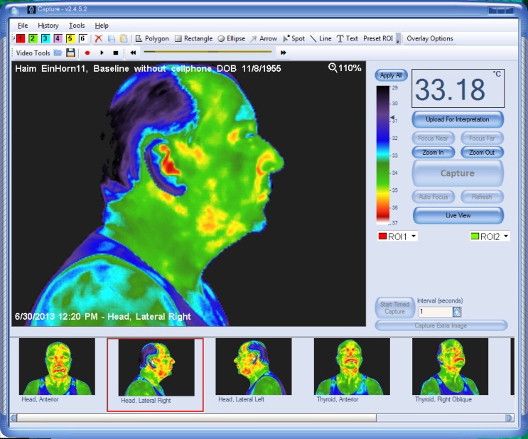 Baseline FLIR thermal image — subject with no phone after 15 minutes acclimation, even thermal distribution across the head