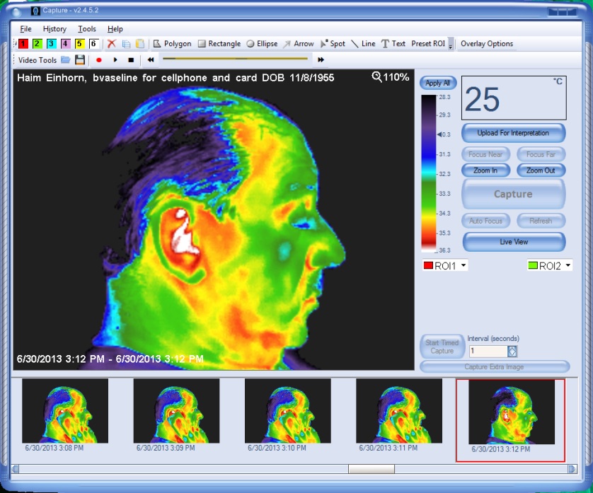 FLIR thermal image after 45 minutes of phone use with BioChip applied — visibly smaller and less intense hot zone, head closer to baseline distribution